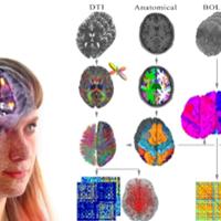 Automated Pipeline for creating Individualised brain models
